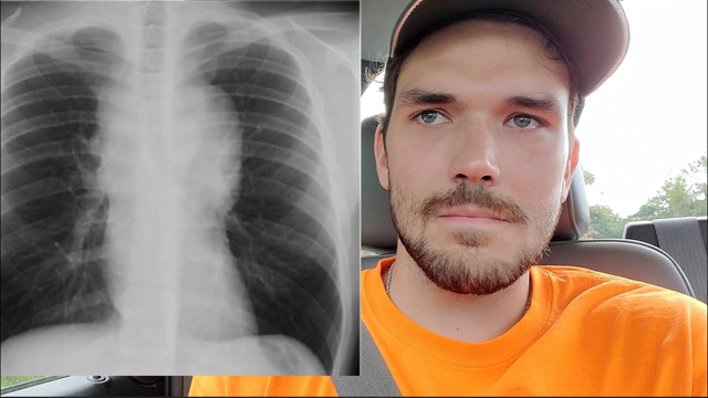 So I have Cancer: Now What?