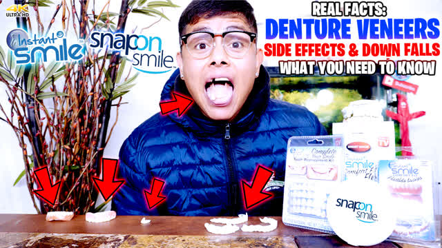 Dental Veneers Side Effects & Down Falls