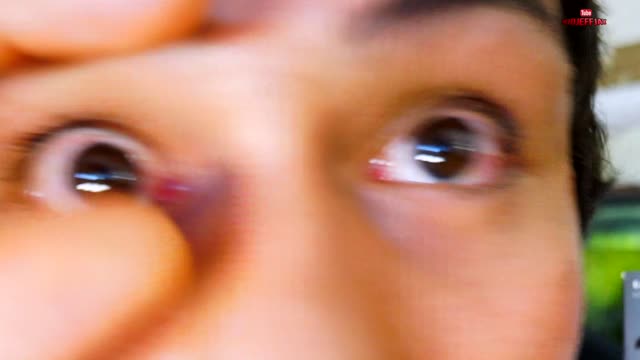 Lumify Eye Drops Review | Super Clear & White Eyes