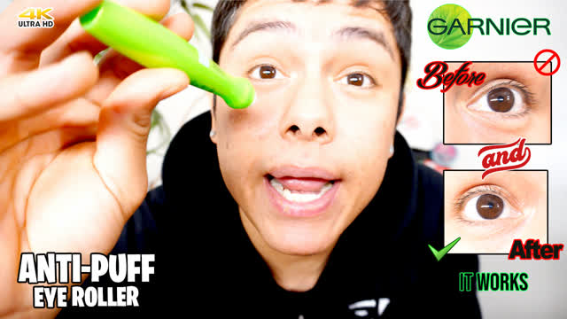 How to get rid of Eye bags