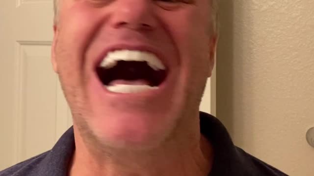 Shiny Smile Veneers is it worth your money?