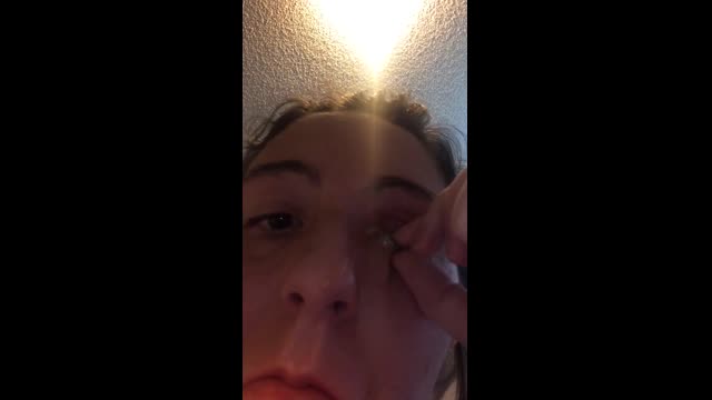 Look away!!! Juicy Eye Socket Infection