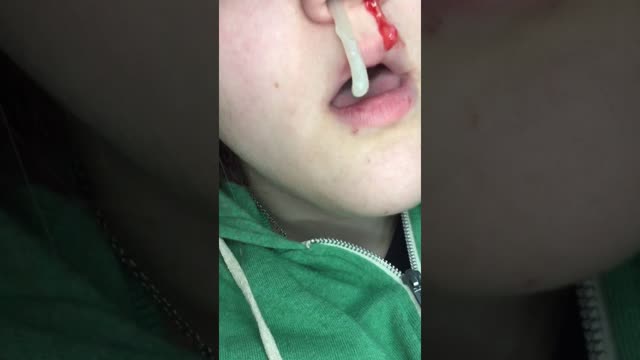 [GROSS] String of Mucus Pulled From Nose