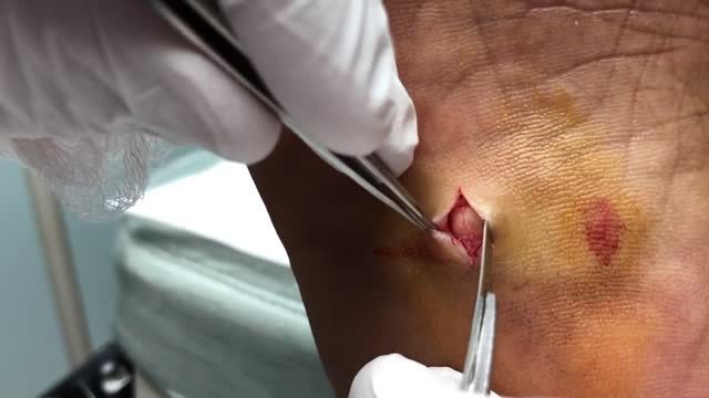 Alien Mass Pops Out of Foot, Area 51