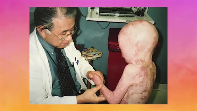 I Have 95% Burns - But I'm Thriving | SHAKE MY BEAUTY