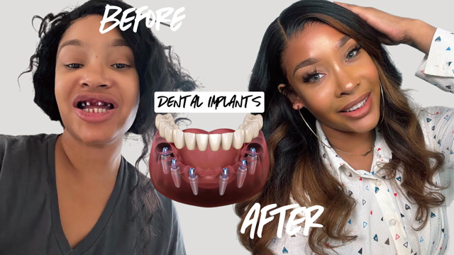STORYTIME: I GOT DENTAL IMPLANTS & CRIED!!! 😭