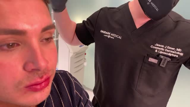 MALE RUSSIAN LIP "KEYHOLE POUT" PLUMPING WITHOUT LOOKING OVERDONE USING VOLLURE | Dr. Jason Emer