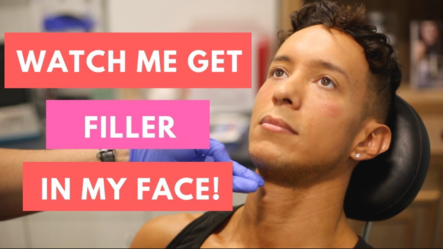 Getting Chin & Cheek Fillers (1st Time!)
