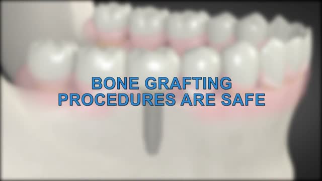 What is a dental bone graft?