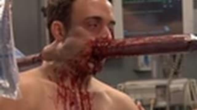 Pipe in the Head | Untold Stories of the ER