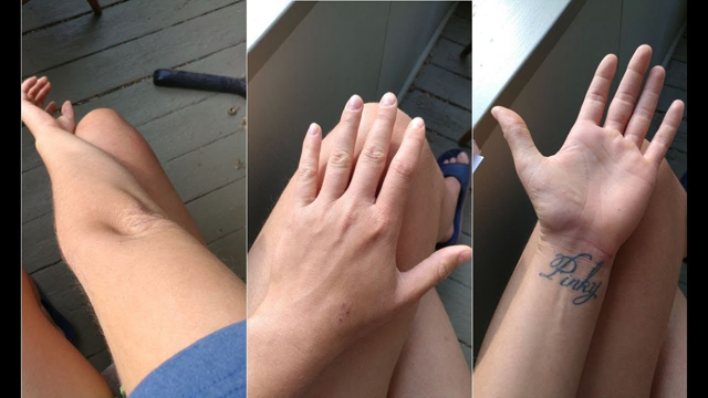 The Environment ISN'T Causing your Eczema, It's your Diet